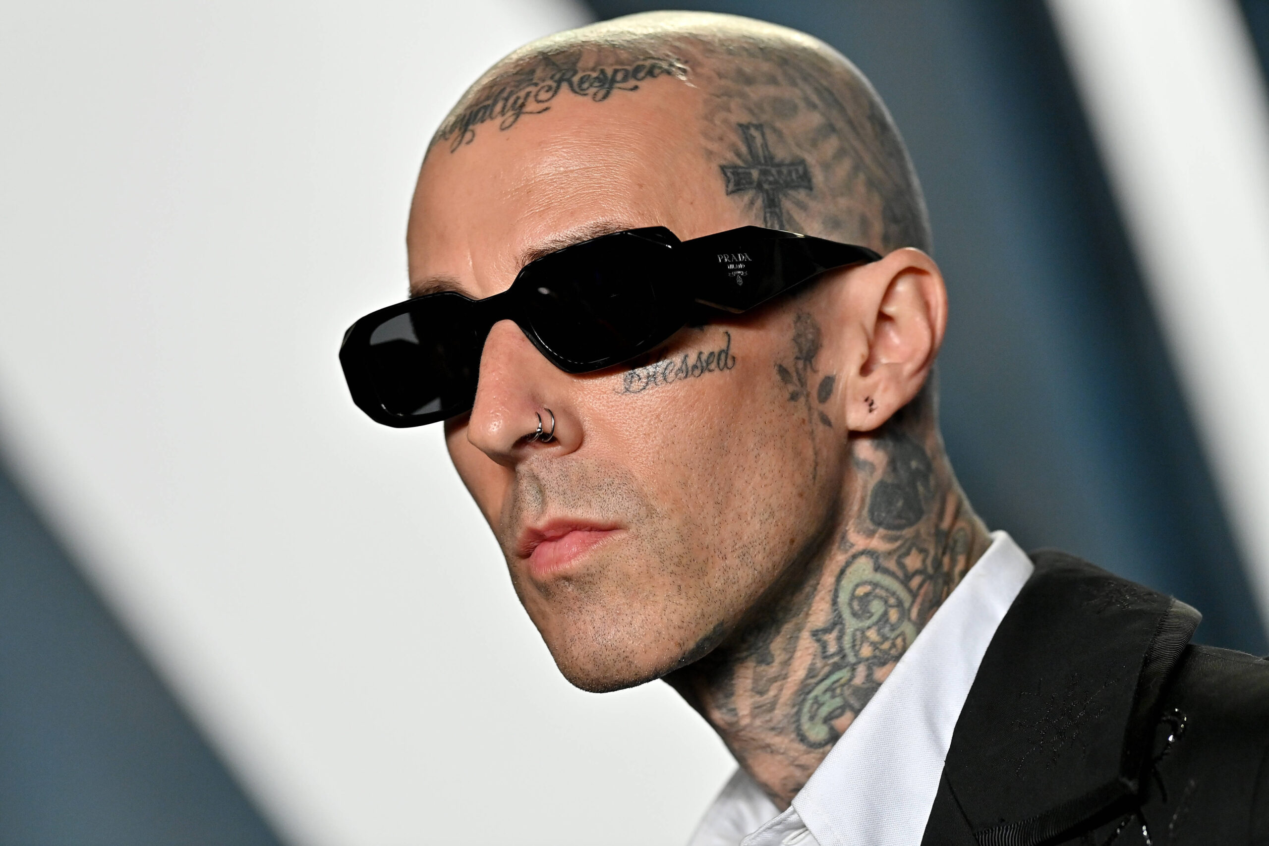 Travis Barker Es Hospitalizado De Emergencia En Los Angeles.jpg