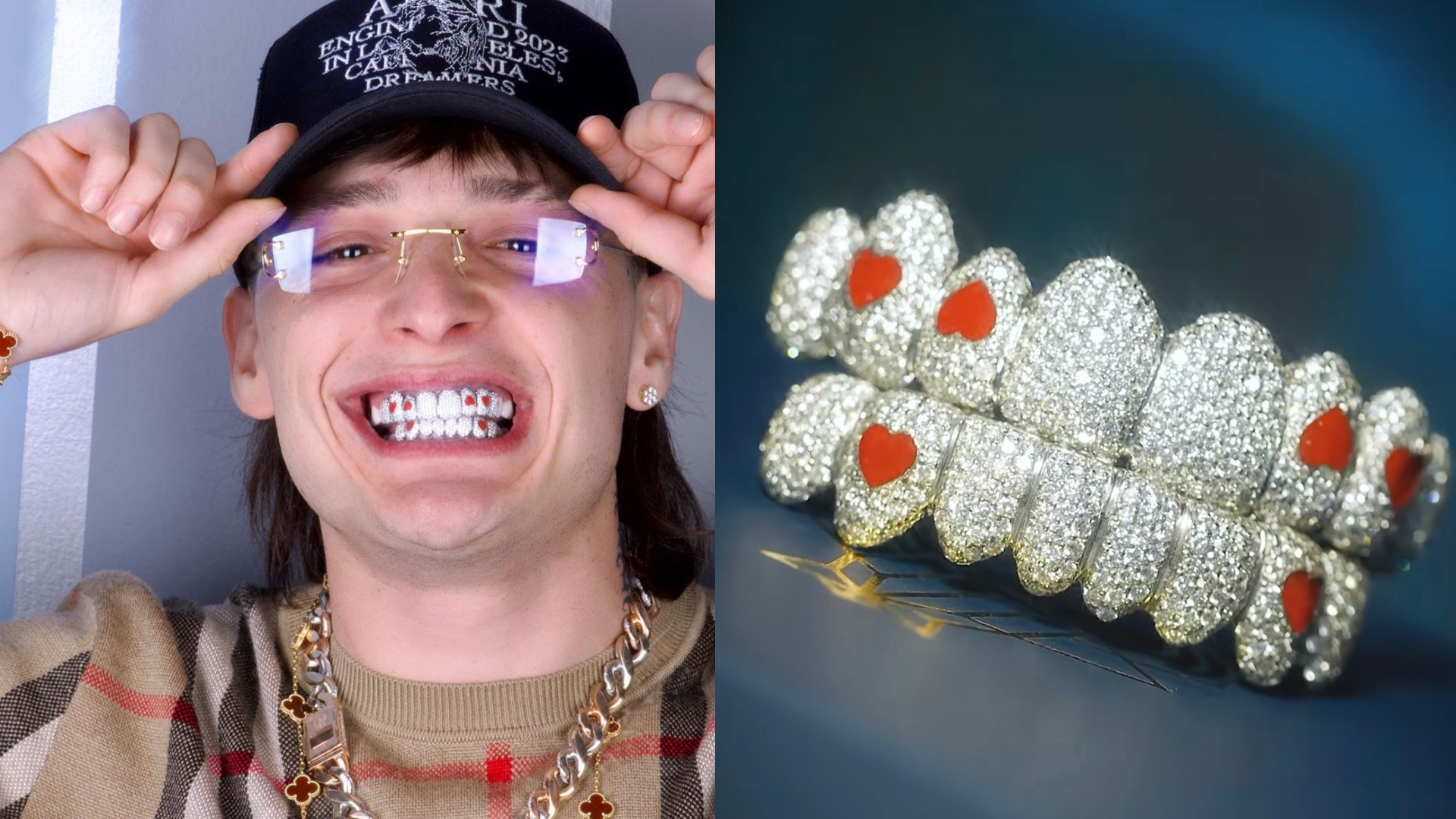 Así fue como Peso Pluma estrenó dentadura de un millón de pesos